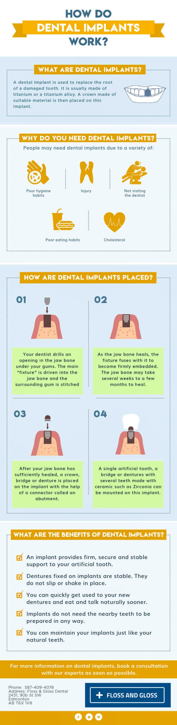 How do Dental Implants Work? - Dentist Edmonton - Floss & Gloss Dental