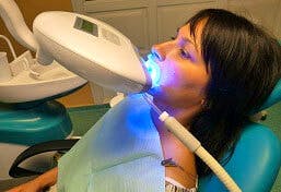 Teeth Whitening - Floss & Gloss Dental